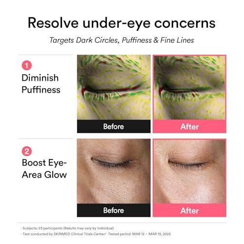 Abib PDRN Glow Jelly Duo: Retinal Eye Patches with Niacinamide, 60 Count & Vegan Collagen Lip Mask Glazed Jelly 0.38 fl oz | Eye Patches for Puffy Eyes Lip Sleeping Mask for Dry Lips Korean Skin Care - view 3