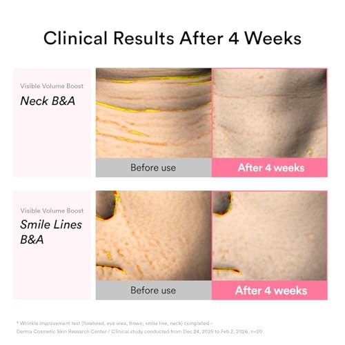 Abib PDRN Volume Pumping Duo: PDRN Volume Fill-It Cream & Vegan Collagen Lip Mask Glazed Jelly – Peptide Retinal Firming for Forehead, Smile Lines & Neck Wrinkles, Korean Sleeping Mask for Dry Lips - view 4