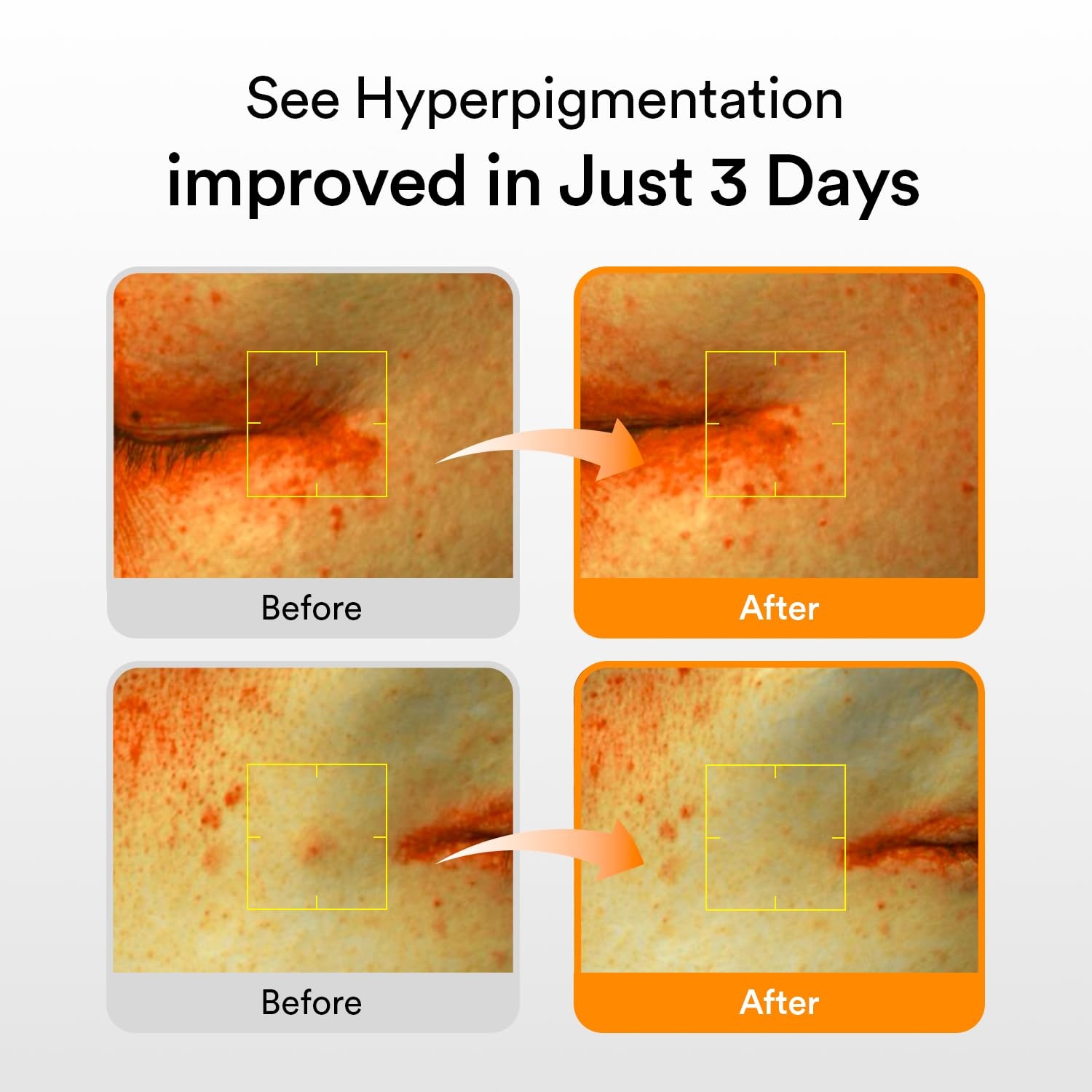 Abib Glutathione Eye Patch & Dark Spot Serum Duo | Brightening Set for Dark Circles, Dark Spots & Hyperpigmentation, Korean Skincare for Sensitive Skin - view 5