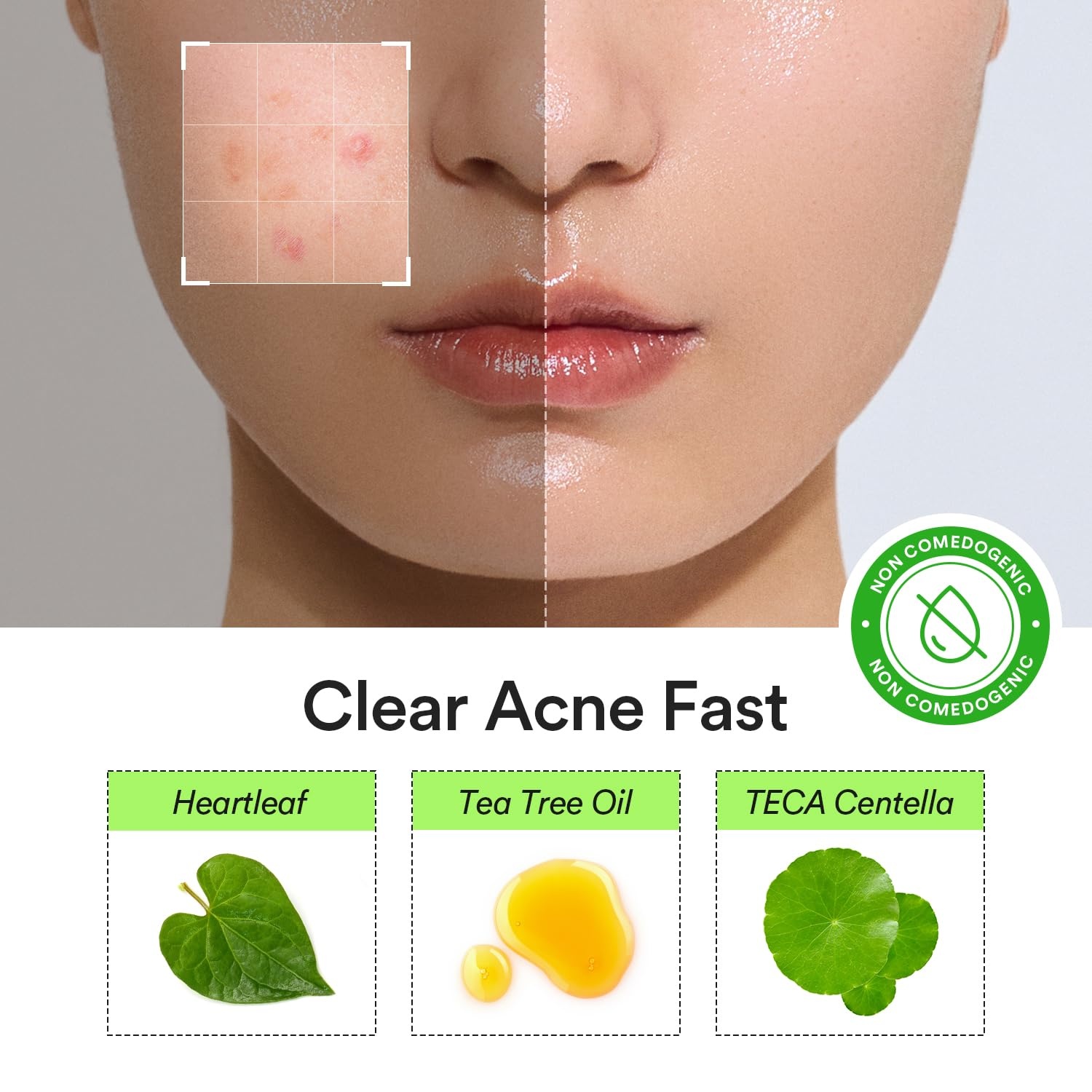 Abib Heartleaf Calming Spot Patch 2 Sizes 78 Patches, Waterproof Pimple Patches for Face, Invisible, Ultra-Adherent & Fast-Soothing Zit Care (10mm*48pcs / 12mm*30pcs) - view 2