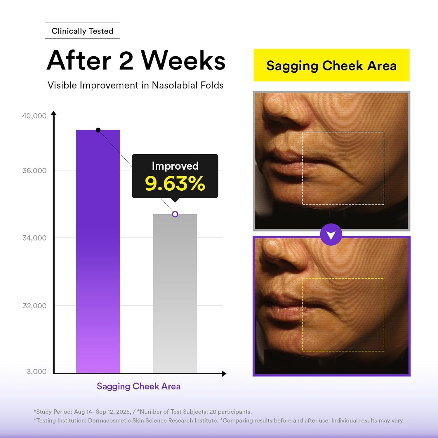Abib Silhouette Lifting Cream Mask V-up Solution (4 sheets) with PLGA-Peptide, Jawline Double Chin Firming, Lifting Mask, Elasticity Care, Face Lift Mask, Skin Tightening, Chin Lift, Korean Skincare - view 6